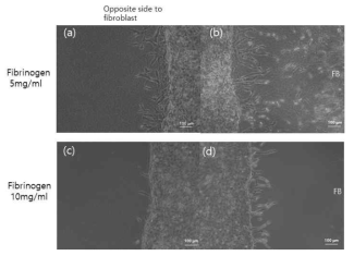 fibrinogen 지지체 농도에 따른 신생혈관 형성 변화. 농도가 낮을 때 섬유아세포가 없는 방향으로도 혈관이 형성되지만, 높을 때에는 섬유아세포 방향으로만 혈관형성이 유도됨