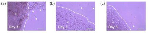 피브린 농도에 따른 세포 분포 양상. 피브린 농도가 (a) 6mg/ml, (b) 8mg/ml, (c) 10mg/ml 로 높아질수록 세포가 누수되는 현상이 줄어듦. * = Min6가 포함된 피브린 하이드로젤. Scale bar = 100μm
