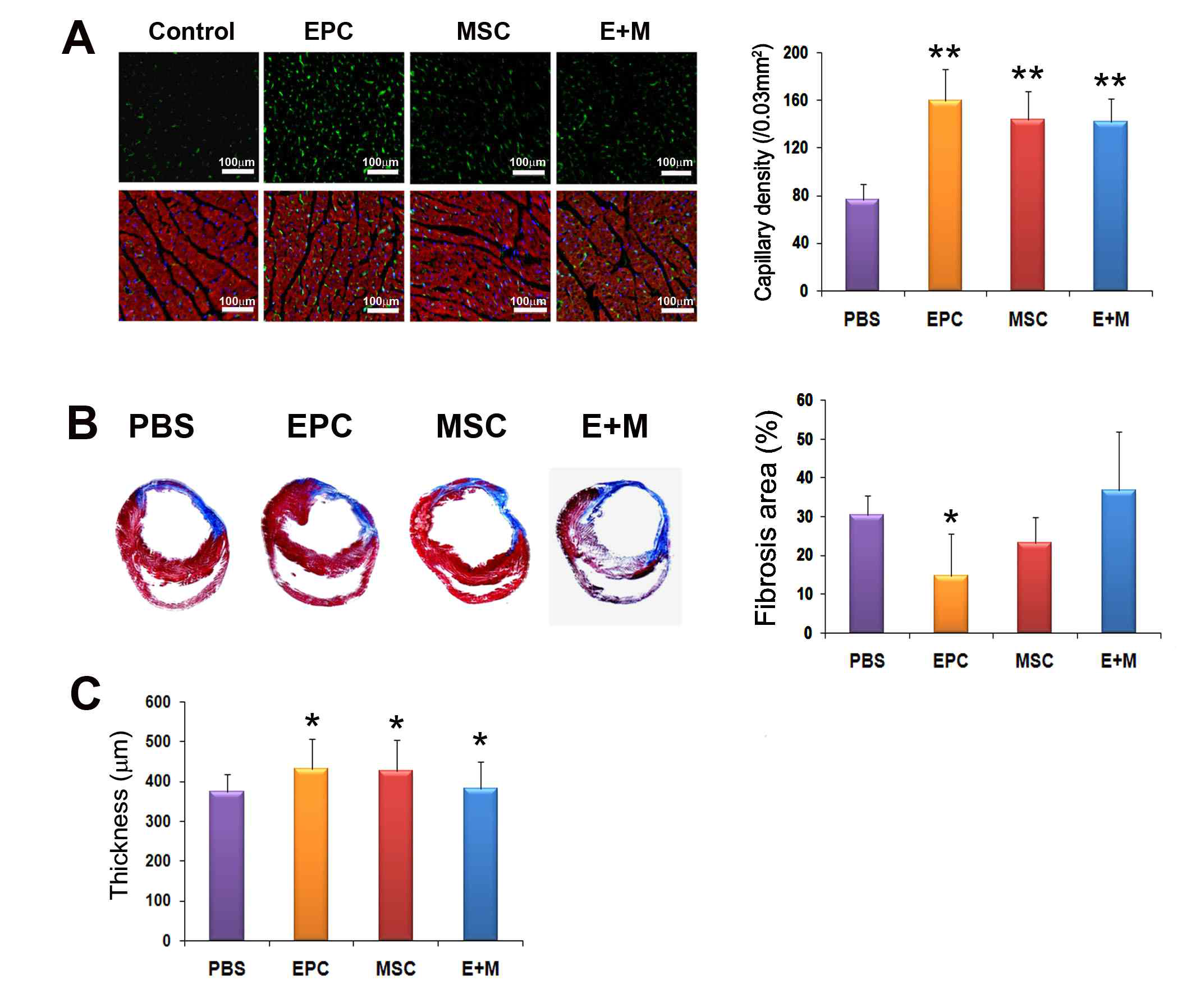 생체내 심장 손상 기능 평가. 모세혈관 생성능력(A), 심장의 fibrosis 결과(B), 심장의 두께(C)