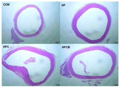 Microscopic analysis of the hematoxylin and eosin-stained aorta sections of female SD rats (×100 magnification)