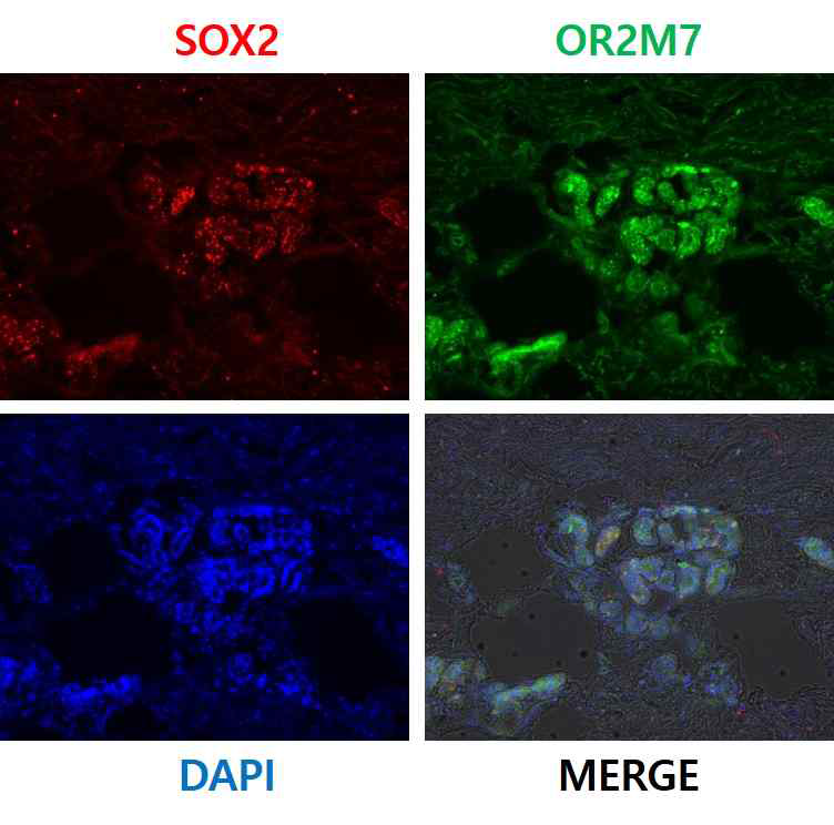 SOX2/OR2M7 공염색