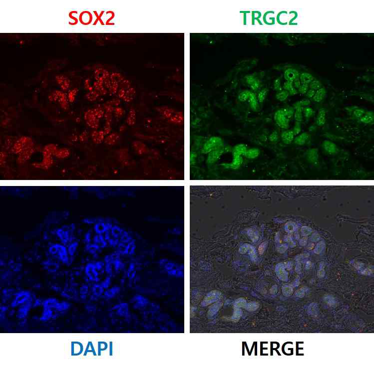 SOX2/TRGC2 공염색