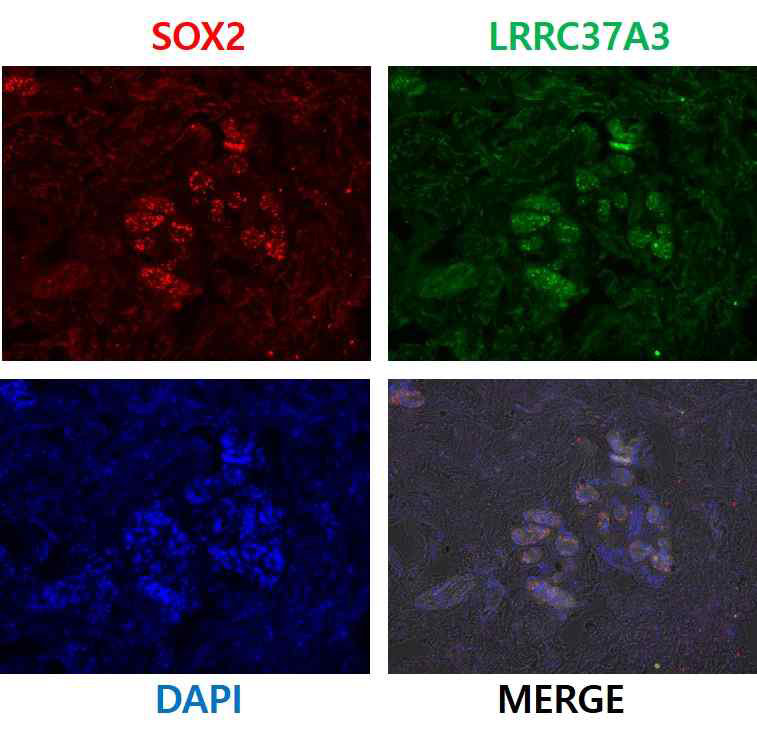 SOX2/LRRC37A3 공염색