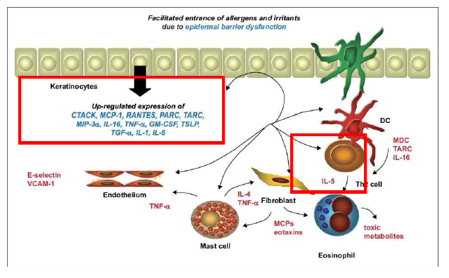 아토피 피부염의 병리 기전
