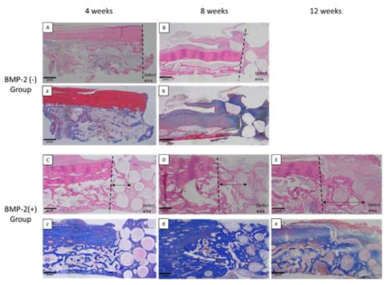 BMP-2 (-) 그룹 및 BMP-2 (+) 그룹의 H&E and Masson’s trichrome.