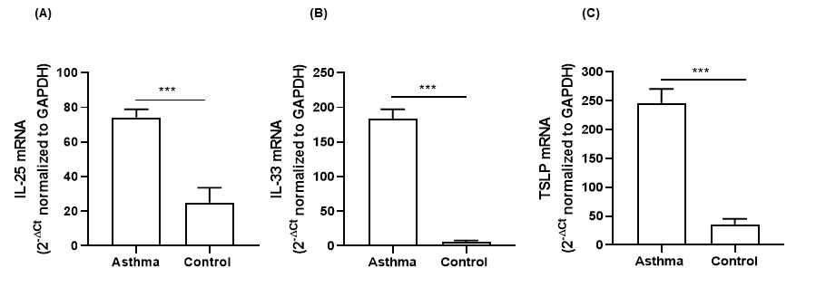 Levels of IL-25 (A), IL-33 (B), and TSLP (C) in the induced sputum of asthmatic patients and normal controls. Levels of mRNA were determined using real-time PCR. The data are presented as the means ± SEMs (Mann-Whitney U test, ***p < 0.001)