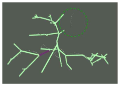 Portal vein skeleton을 3차원 line segment로 모델링한 사용자 인터페이스 (관심 혈관 선택 (자주색 부위), 혈관 삭제 (녹색 원형 점선 부위))