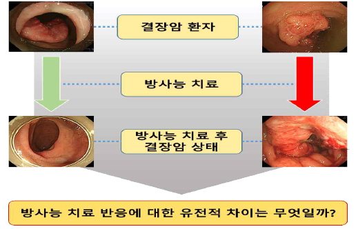 방사선 치료의 차이를 보이는 예 좌) 방사선 치료 후 병변이 거의 없어졌다 우) 방사선 치료에도 불구하고 병변의 크기가 커졌다.