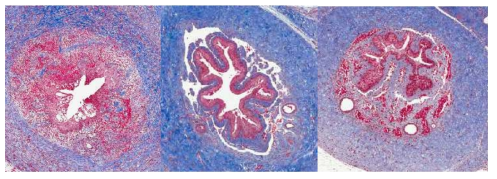 요도 Masson’s Trichrome 염색 결과. 각각 질환모델 대조군, 질환모델 줄기세포 치료군, 및 정상 대조군