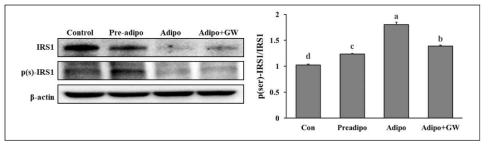 지방세포의 culture medium을 처리한 근육세포의 IRS-1 serine phosphorylation 변화