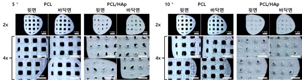 교정 각도 5°와 10°로 제작된 지지체 (Scale bar: 1mm)