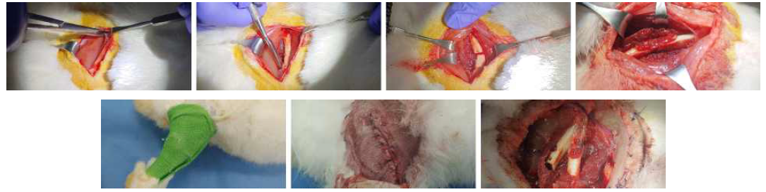 토끼 대퇴골에 3D 프린팅 쐐기 이식 후 흡습성 고정판과 나사 고정 및 이탈 부위