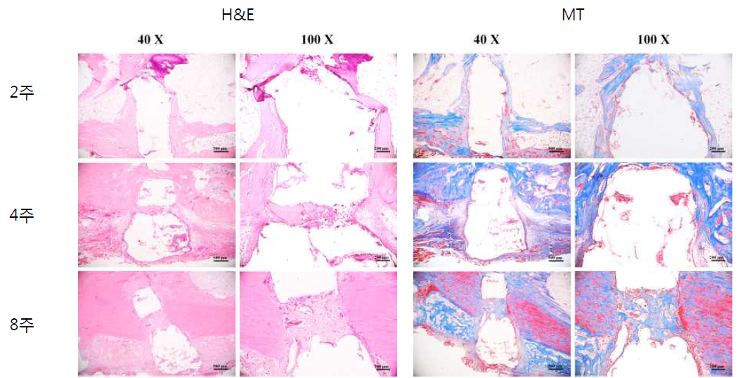 수술 후 2, 4, 8주차의 H&E 염색