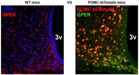 일반 마우스 (좌)와 POMC-tdTomato 마우스 (우)의 뇌 조직에서 수행한 GPER 면역조직염색 결과