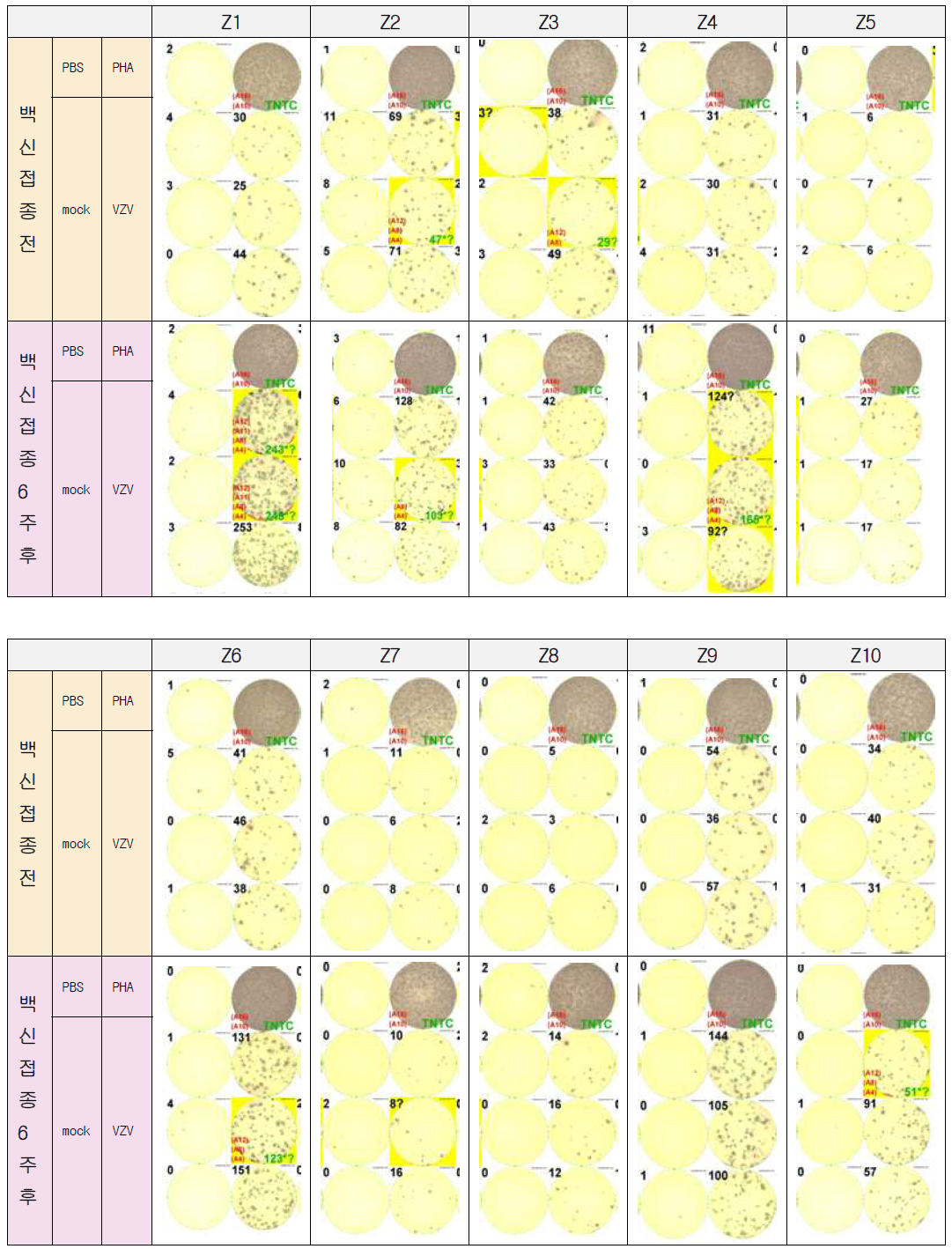 수두대상포진바이러스 IFN-γ ELISpot assay 결과