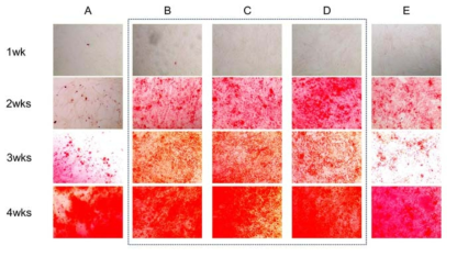 Alizarin red S staining showed more prominent and earlier mineral synthesis in co-culture of ADSC and chondrocyte. (A) Isolated culture of adipose-derived stem cells (ADSC). (B,C,D) Co-culture of ADSC and chondrocyte. The ratio of ADSC and chondrocyte was 3:1(B), 1:1(C), 1:3(D) respectively. (E) Isolated culture of chondrocytes