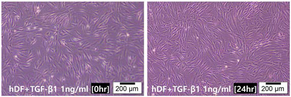 hDF에 TGF-β1을 투여한 후 24시간 경과 후의 사진. 세포 증식 및 분화가 활발한 것을 암시하고 있음