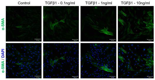 2X105개의 hDF를 배양하면서 여러 농도의 TGF-β1을 투여하여 분화를 촉진시키고 면역세포화학 검사를 시행함. α-SMA의 형광이 TGF-β1의 농도에 비례해 발현 증가되는 소견을 보이고 있음