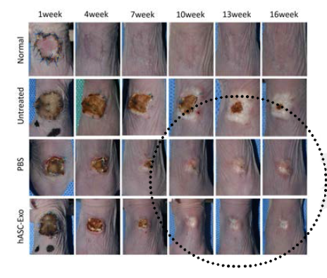 hASC-Exo 투여군에서 흉터가 타군에 비해 감소하는 것이 확인됨