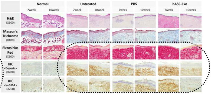일반 염색 및 면역조직 화학 검사 결과 hASC-Exo 군에서 흉터와 관련된 Collagen 침착이 완화됨