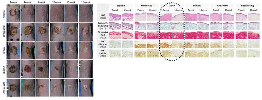 일반 염색 및 면역조직 화학 검사 결과 siRNA를 형질 주입한 hASC-Exo 투여군에서만 흉터 관련 Collagen침착이 완화된 소견 보였으며 다른 군에서는 불확실한 결과를 보임
