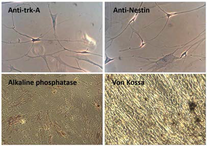 Immunocytochemical Analysis [위두사진] 신경 세포 분화 확인 (위왼쪽) Anti-trk-A염색 (위오른쪽) Anti-Nestin염색 [아래두사진] 골 분화 확인 (아래왼쪽) Alkaline phosphatase염색 (아래오른쪽) Von Kossa염색