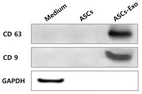 추출한 엑소좀에 대한 Western-blotting 결과. 엑소좀 특이 항원인 CD63, CD9 양성 소견