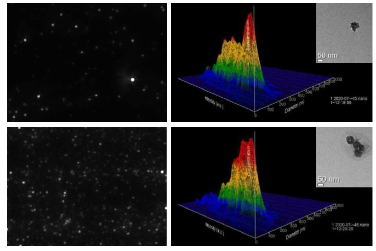 Nanoparticle Tracking Analysis(NTA, Nanosight NS300) 분석 및 전자현미경(TEM) 분석 (위) 면역친화성 컬럼 방식 (Capturem Kit) (아래) 침전 방식 (TEI kit)