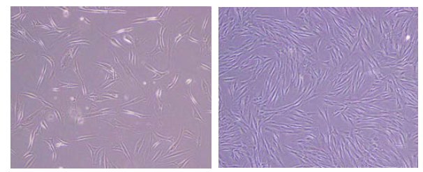 인체 피부 유래 섬유아세포 (human dermal Fibroblast, hDF) (좌) CCD-986sk (Passage 1) (우) 공여받은 피부에서 추출 (Passage 3)