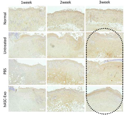 Immunohistochemistry (Collagen I) hASC-Exo군에서 뚜렷이 증가되지는 않았으나 하지만 Collagen 배열이 보다 균일하고 조밀함