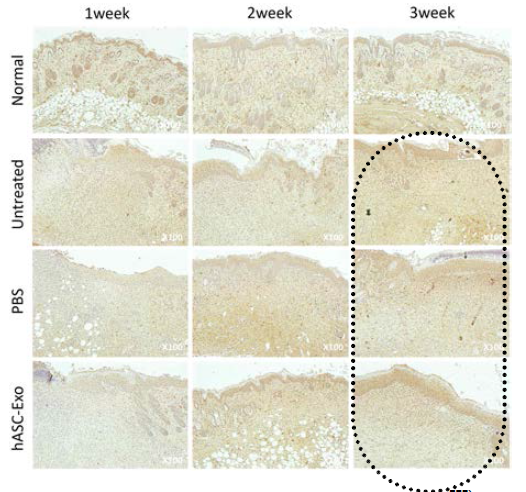 Immunohistochemistry (Collagen III). hASC-Exo군에서 타군에 비해 증가 소견 보이고 Collagen 배열도 보다 균일하고 조밀함