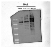 급성골수성백혈병 세포 HEL92.1.7에서 Anti-C-KIT-HRP 방법을 사용하여 레이블링 되는 단백질체를 알아내기 위한 분석도