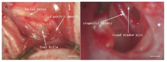 백서에서 otic bulla를 통하여 round window 로 접근하는 수술법