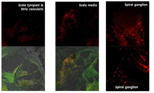 줄기세포를 주입한 후 와우의 면역형광염색 결과