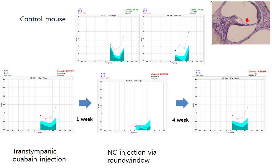 이독성난청 모델에서 줄기세포 주입에 따른 otoacoustic emission test 변화