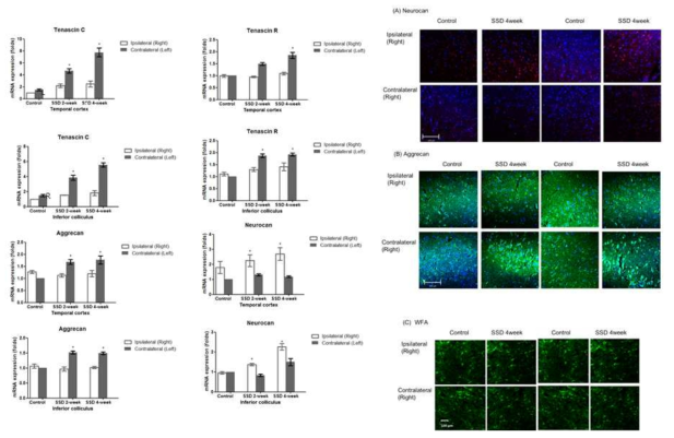 난청렛트에서 청신경계 변화 관련 마커들 (tenascinC, tenascinR, aggrecan, neurocan)