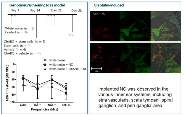 소음 및 cisplatin을 이용한 감각신경성 난청 모델에서 줄기세포 주입의 청력보호 효과