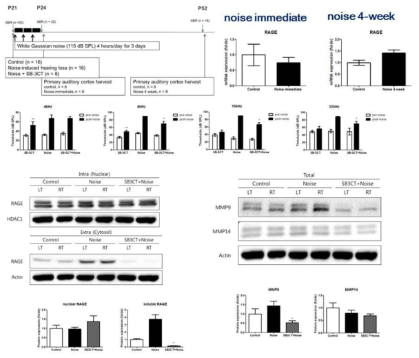 감각신경성난청 모델에서 RAGE 증가 및 SB3CT 주입에 따른 RAGE 억제 및 청력보호
