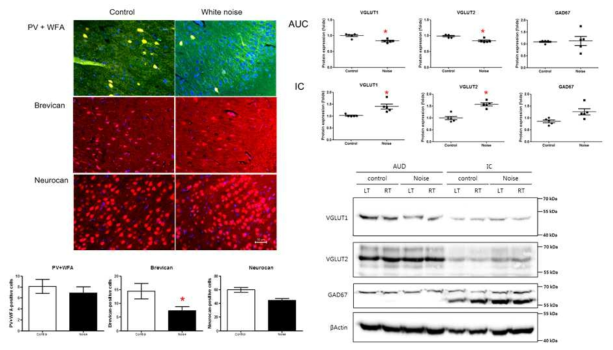 만성감각신경성 난청 모델에서 brevican의 감소 및 VGLUT1, VGLUT2의 감소를 보임