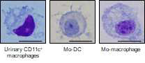 루푸스 신염 환자의 소변 CD11c+ 대식세포의 형태학적 특성 (Mo-DC; monocyte-derived dendritic cell, Mo-macrophage; monocyte-derived macrophage)