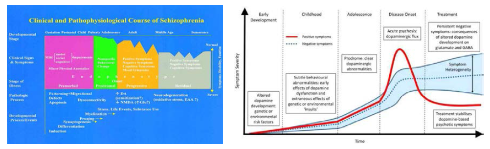 조현병의 임상적 병태생리학적 경과