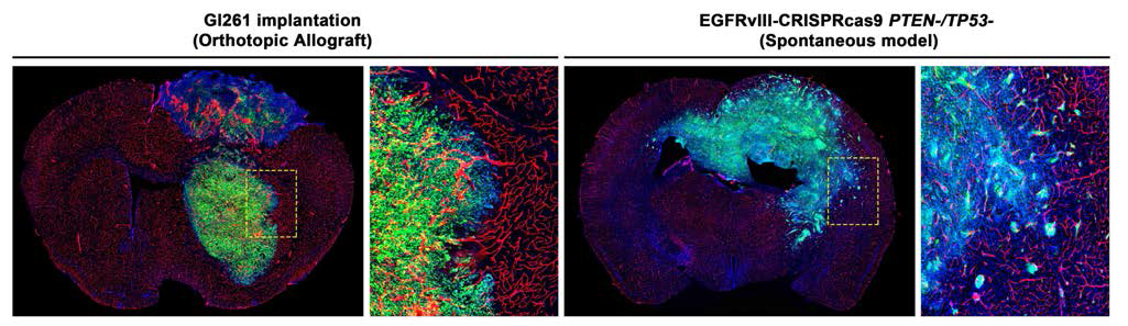 Gl261 세포주를 마우스 뇌에 주입하여 만든 뇌종양 모델(좌), CRISPRcas9 시스템으로 유전자 변형을 통한 자연발생 교모세포종 모델(우)