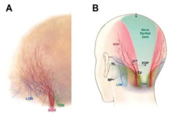 모든 표본의 신경들을 표지하여 중첩시킨 이미지 (A) 와 전형적인 신경분포 양상 (B). nerve rarified zone이 3등분된 중간 영역에 존재함. 축약어: Ep, emerging point of GON; EOP, external occipital protuberance; GON, greater occipital nerve; LON, lesser occipital nerve; MP, the lowermost point of mastoid process; NL, horizontal line through the bilateral E points; TON, third occipital nerve; V, vertex point