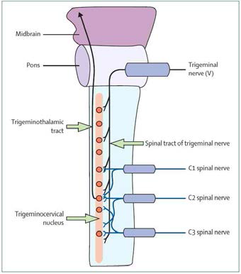 해부학적 수렴(anatomical convergence)에 기반한 상위 경추 신경 (C1-2-3)를 통한 경추성 두통의 발생 기전