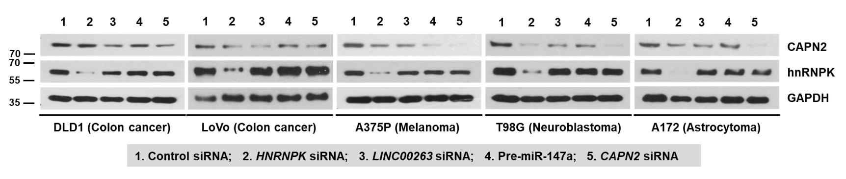 다양한 암종에서 hnRNPK/LINC00263/miR-147a/CAPN2의 검증