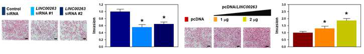 LINC00263의 발현에 따른 암 세포 전이능 조절