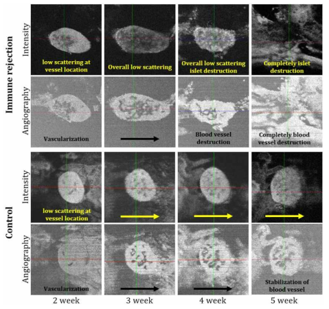DF-OCM(intensity and angiography)로 촬영한 시간에 따른 이식된 췌장소도의 조직구조 및 혈관의 변화