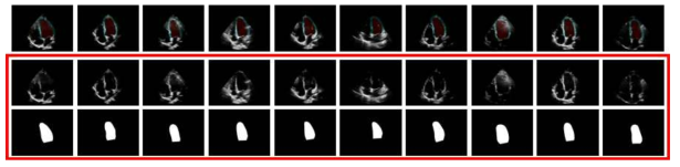 수치실험을 위해 획득한 10 cases의 심장 초음파 영상: 좌심실 분할 딥 러닝 알고리즘의 학습을 위해 사용된 입력데이터(두 번째 및 세 번째 줄)