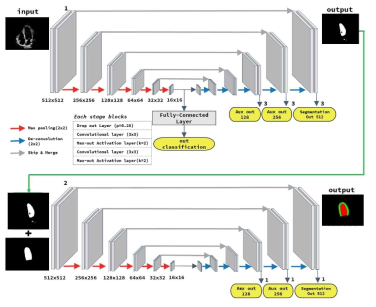 좌심실 영역 분할을 위해 제안한 U-net architecture