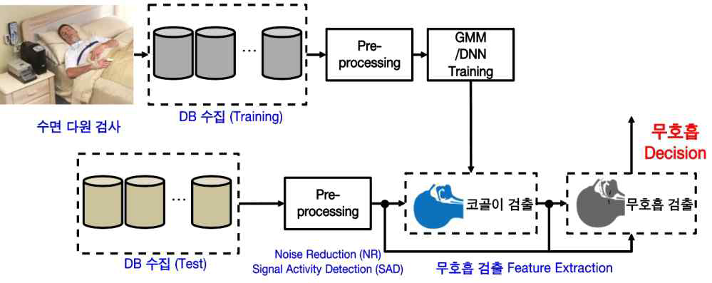 코골이 검출 및 무호흡 증상 검출 개요도